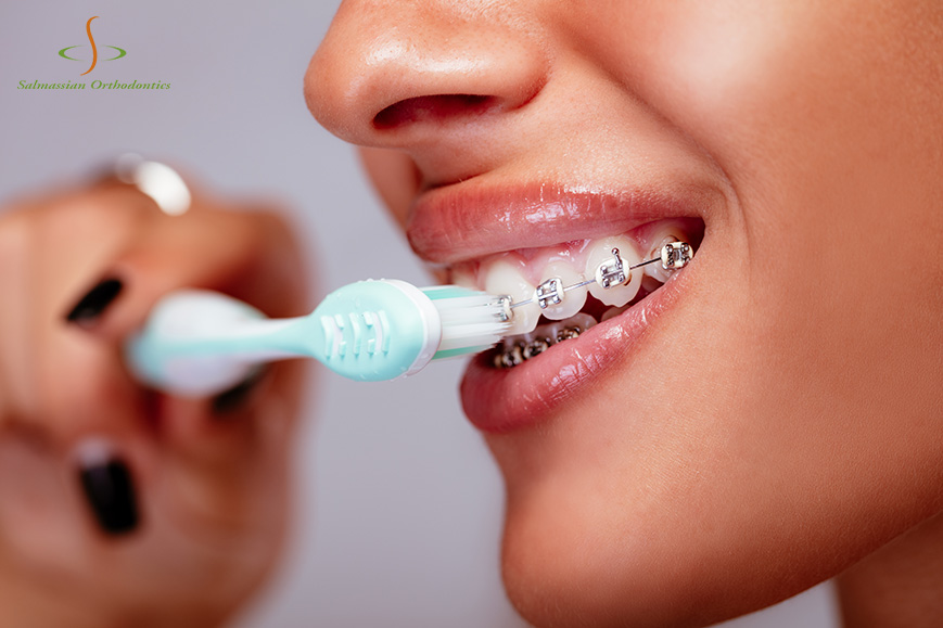 How To Practice Good Oral Hygiene with Braces